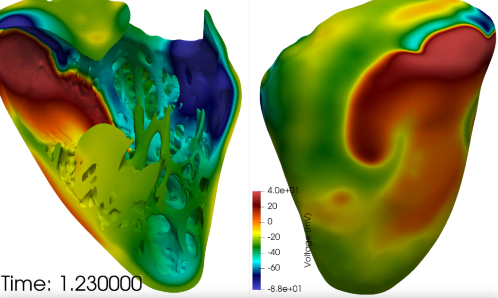 Figure 1: Spontaneous ventricular tachycardia on a human biventricular detailed heart employed as basis of the virtual population.