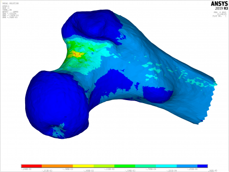 FocusCoE-Use-Case-Booklet_CombBioMed2_CT2S_BoneStrength_figure.png